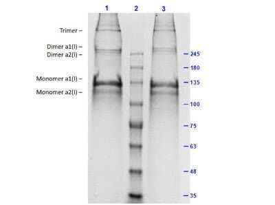 SDS-PAGE: Collagen I Native Protein [NBP1-97266]